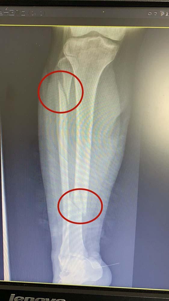 术前.jpg 术前.jpg