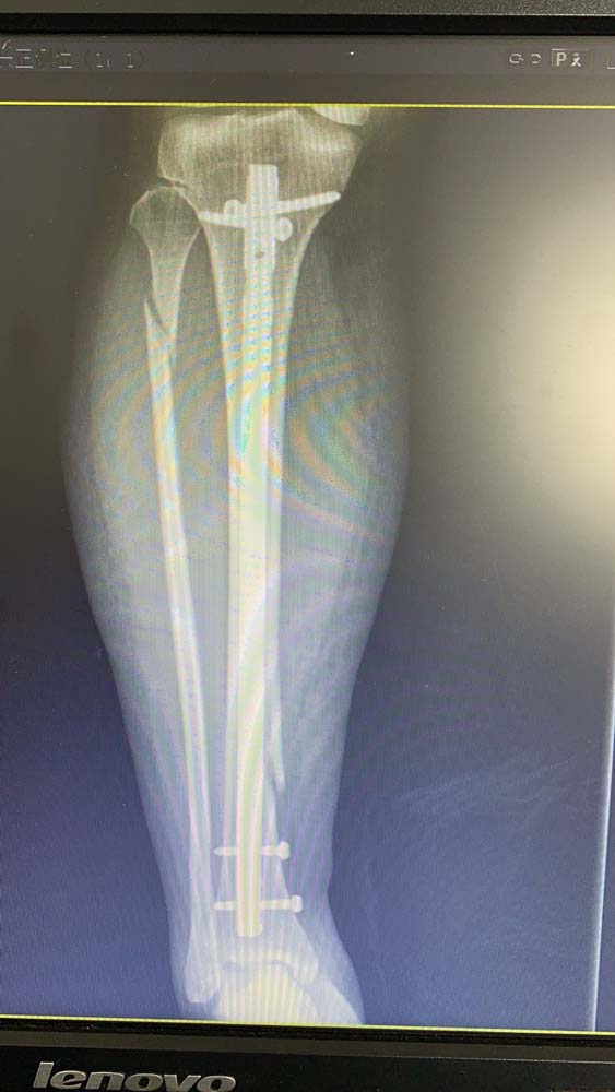 术后.jpg 术后.jpg