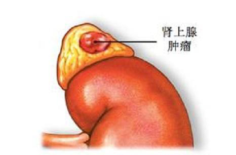 微信图片_202110150811198.jpg 微信图片_202110150811198.jpg