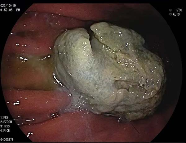 微信图片_20221123161241.jpg 微信图片_20221123161241.jpg