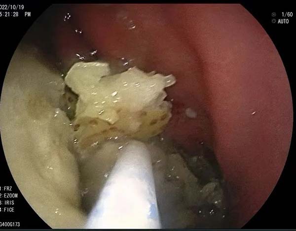 微信图片_20221123161244.jpg 微信图片_20221123161244.jpg