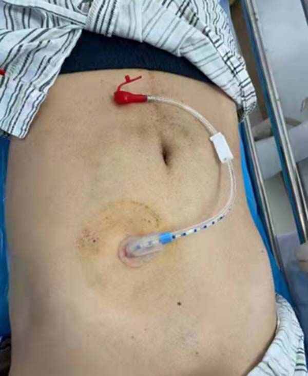 微信图片_20230220154850.jpg 微信图片_20230220154850.jpg