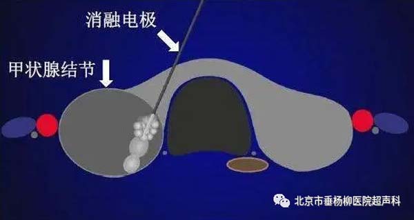 微信图片_20230510090712.jpg 微信图片_20230510090712.jpg