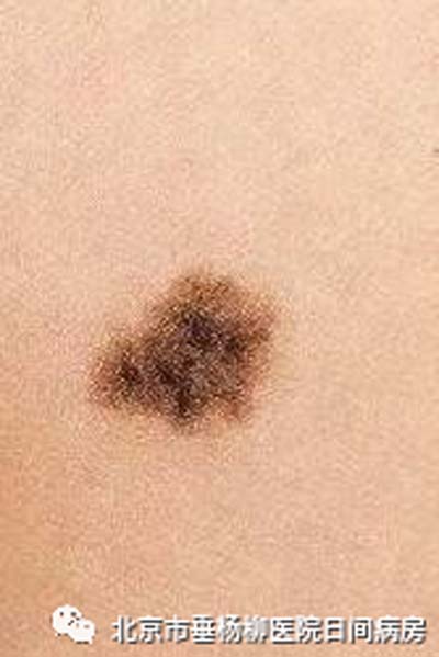 微信图片_20230625170602.jpg 微信图片_20230625170602.jpg