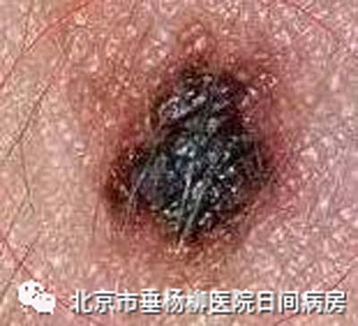 微信图片_20230625170604.jpg 微信图片_20230625170604.jpg