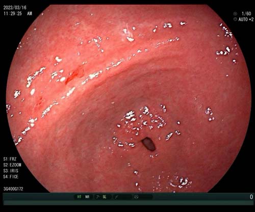 微信图片_20230628170449.jpg 微信图片_20230628170449.jpg