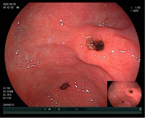 微信图片_20230628170455.jpg 微信图片_20230628170455.jpg