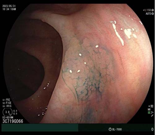 微信图片_20230628170500.jpg 微信图片_20230628170500.jpg