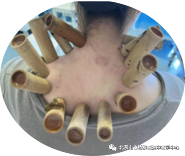 640 (4)_1.jpg 640 (4)_1.jpg