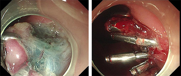 未标题-2.jpg 未标题-2.jpg
