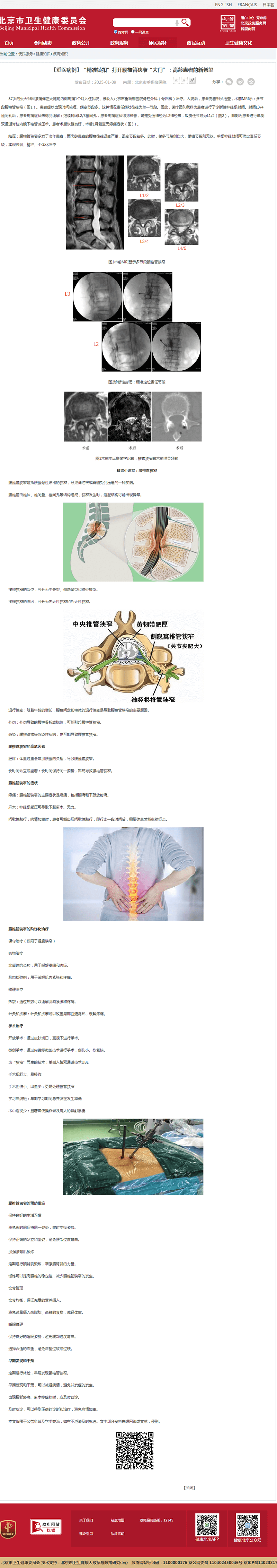 20250109--市卫健委--【垂医病例】“精准锁扣”打开腰椎管狭窄“大门”:高龄患者的新希望.png 20250109--市卫健委--【垂医病例】“精准锁扣”打开腰椎管狭窄“大门”:高龄患者的新希望.png