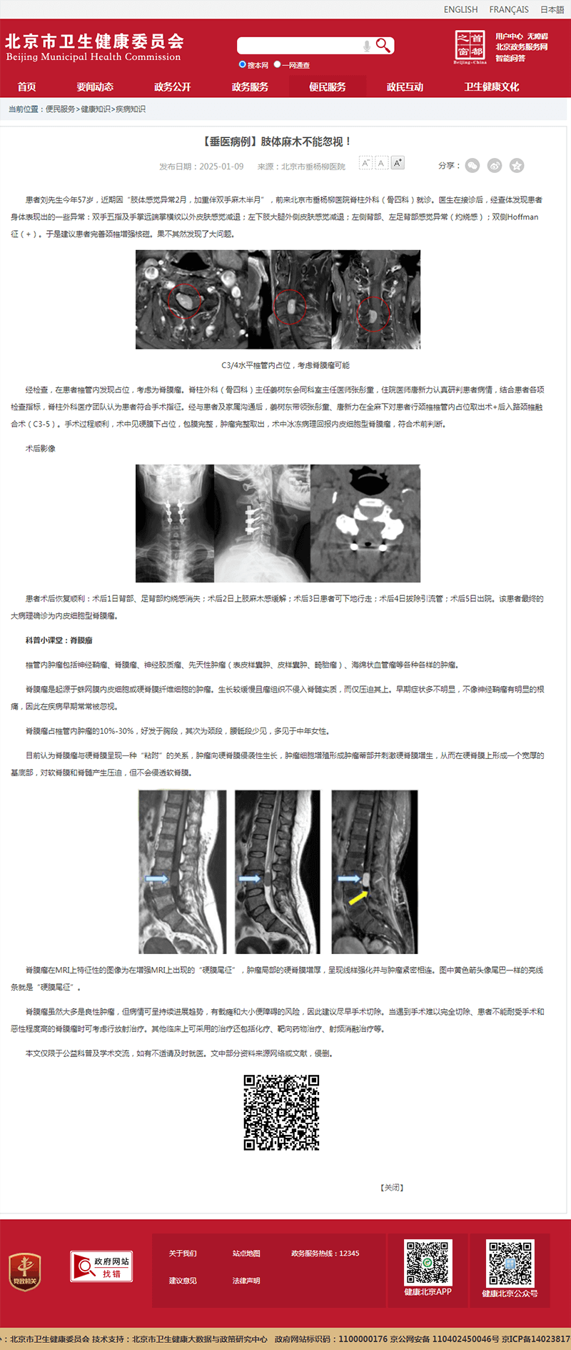 20250109--市卫健委--【垂医病例】肢体麻木不能忽视!.png 20250109--市卫健委--【垂医病例】肢体麻木不能忽视!.png