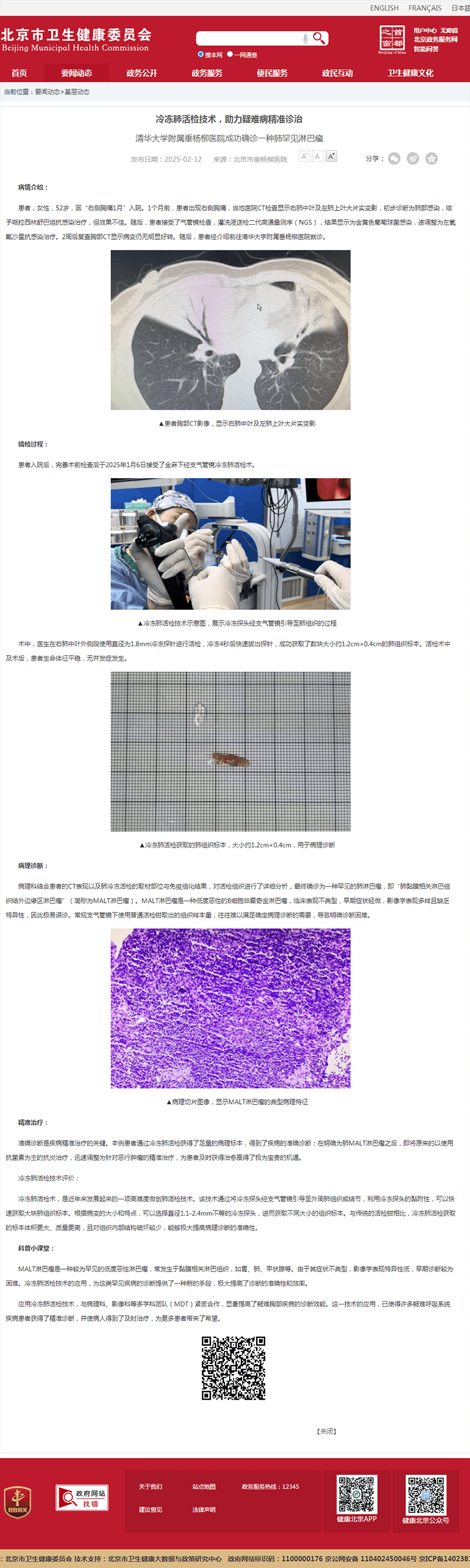 20250212--市卫健委--冷冻肺活检技术,助力疑难病精准诊治.png 20250212--市卫健委--冷冻肺活检技术,助力疑难病精准诊治.png